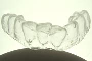 歯の漂白模型１